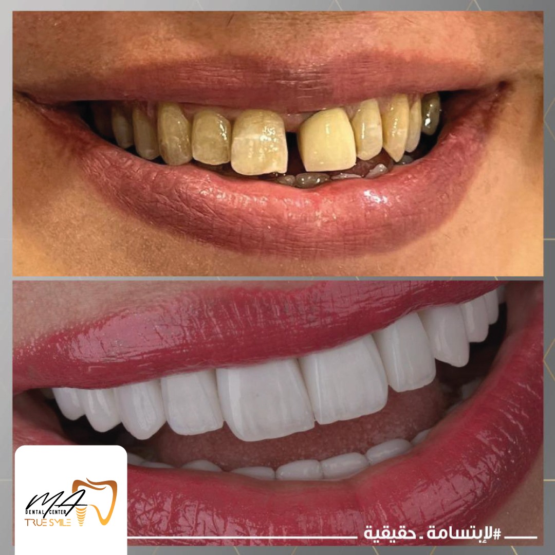 whatsapp-image-2023-10-02-at-10.34.59-pm