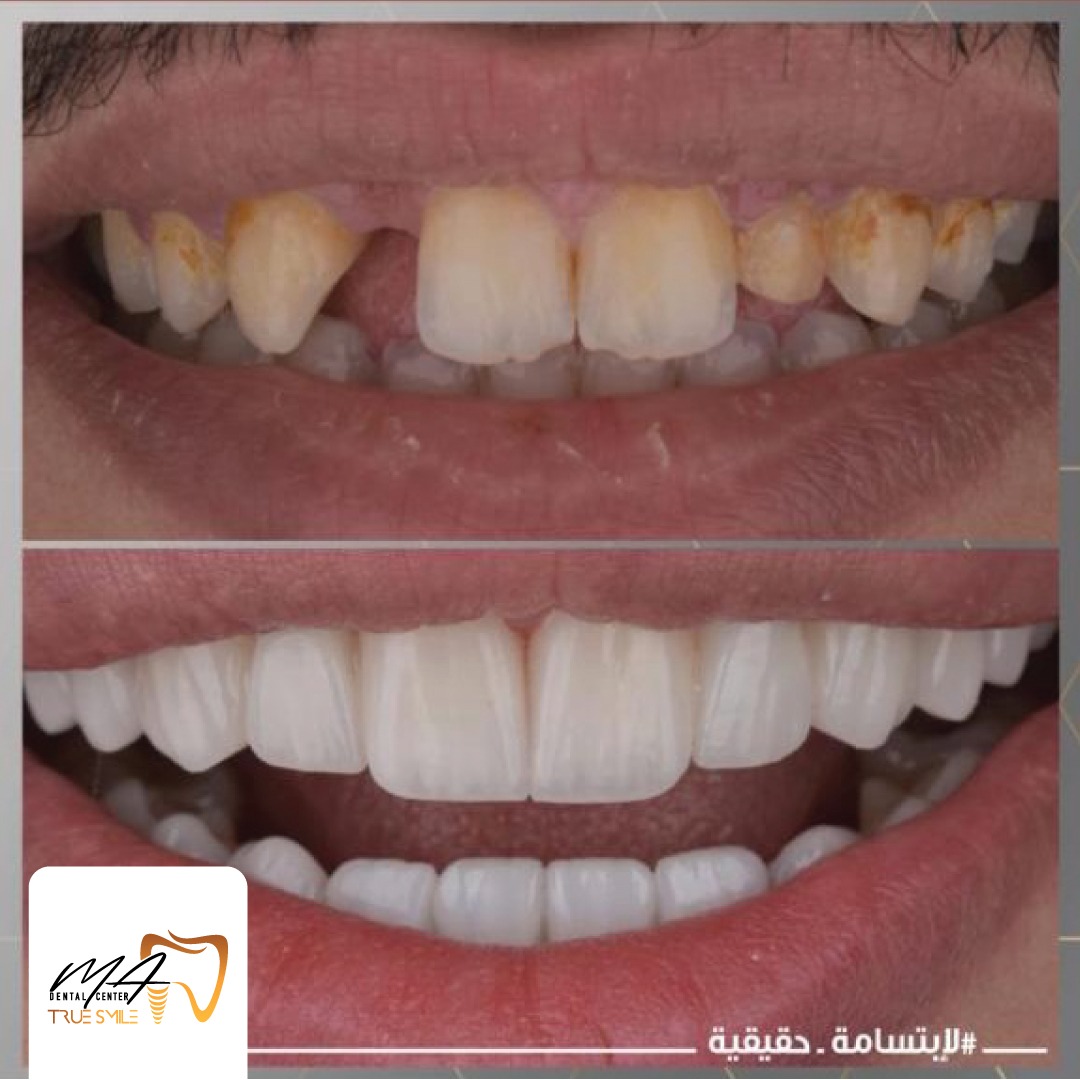 whatsapp-image-2023-10-02-at-10.35.00-pm