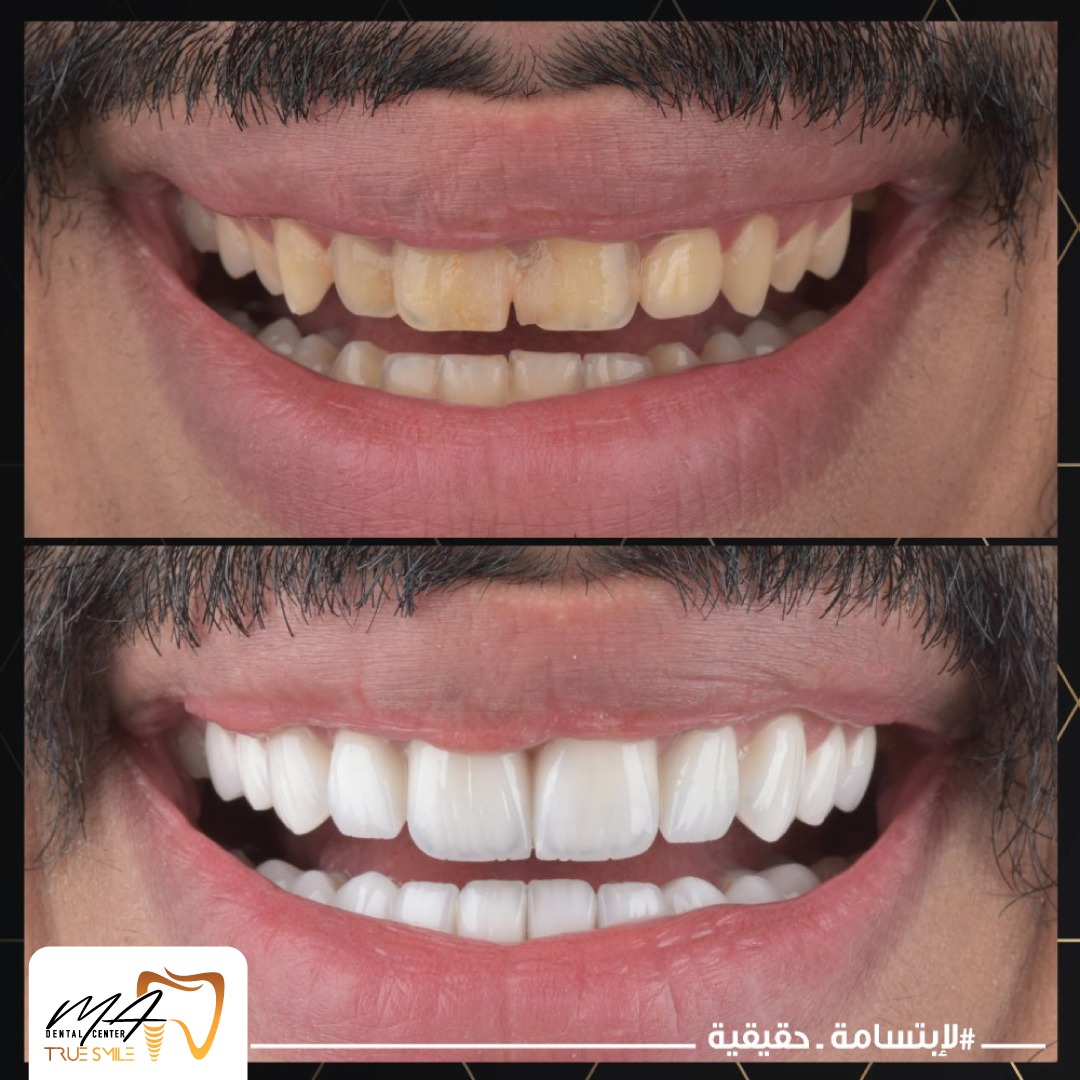 whatsapp-image-2023-10-02-at-10.35.01-pm-1